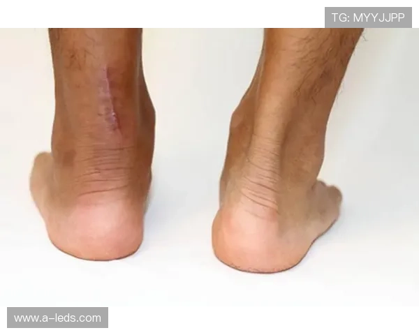 阿圭罗老将赛跟腱断裂需手术